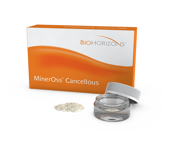 MinerOss Cancellous